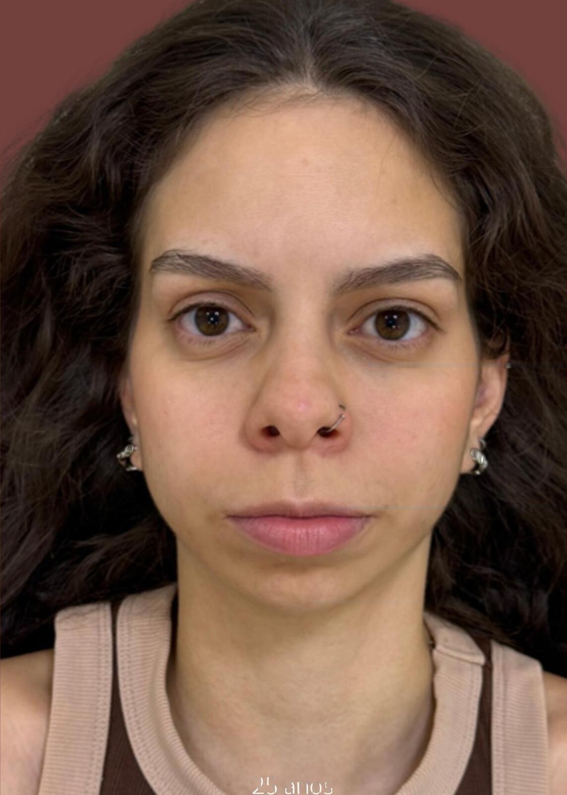 Análise facial · Estrutura jovem com sinais sutis